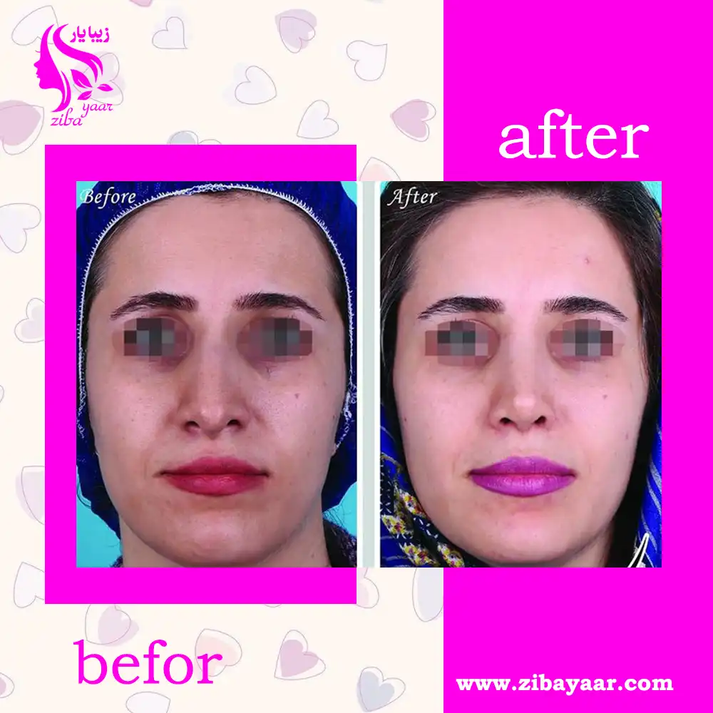 نمونه کار دکتر علیرضا سنمار